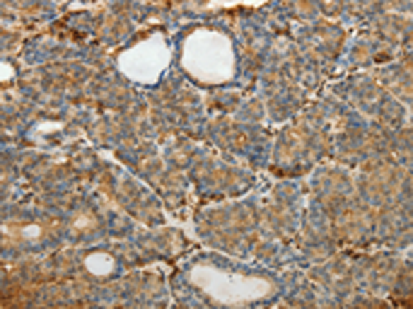 Anti-Estrogen Sulfotransferase Rabbit Polyclonal Antibody