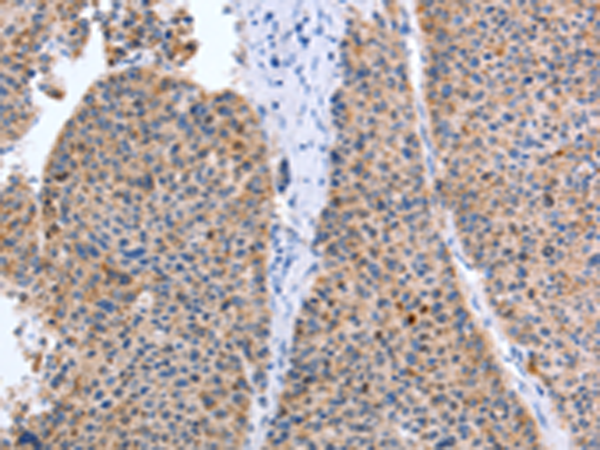 Anti-Tyrosine Aminotransferase Rabbit Polyclonal Antibody