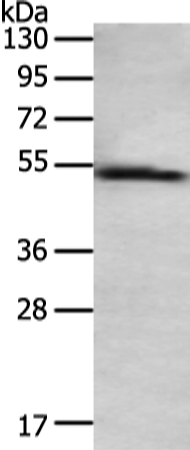 Anti-Tyrosine Aminotransferase Rabbit Polyclonal Antibody