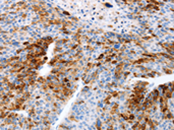 Anti-Estrogen Inducible Protein pS2 Rabbit Polyclonal Antibody