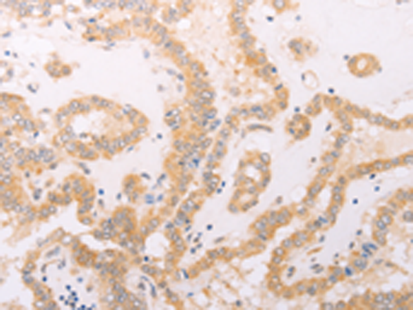 Anti-F7 Rabbit Polyclonal Antibody