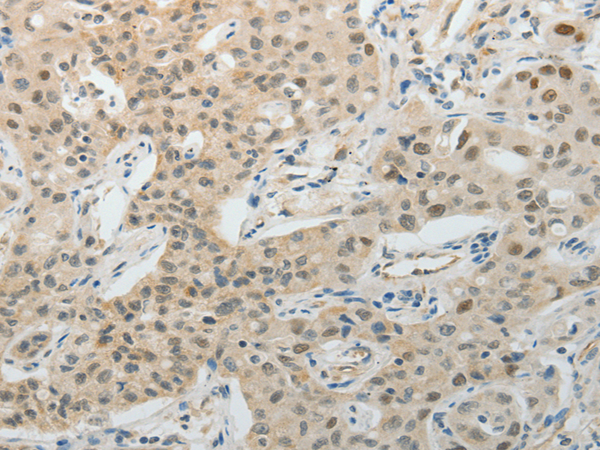 Anti-Tissue Factor Pathway Inhibitor 2 Rabbit Polyclonal Antibody