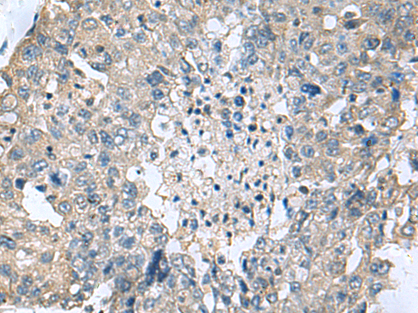 Anti-TGM3 Rabbit Polyclonal Antibody