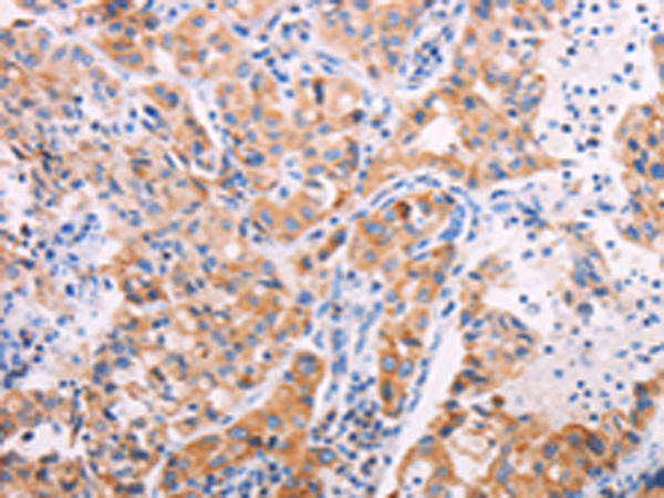 Anti-Tektin 4 Rabbit Polyclonal Antibody