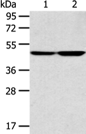 Anti-Tektin 4 Rabbit Polyclonal Antibody