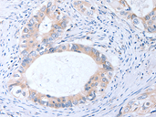 Anti-Metalloproteinase Inhibitor 3 Rabbit Polyclonal Antibody