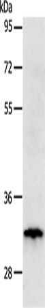 Anti-Metalloproteinase Inhibitor 3 Rabbit Polyclonal Antibody