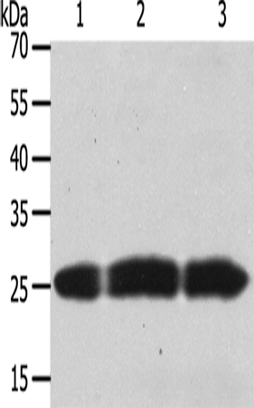 Anti-Metalloproteinase Inhibitor 4 Rabbit Polyclonal Antibody