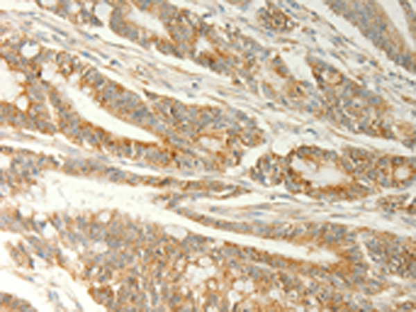 Anti-TRAF1 Rabbit Polyclonal Antibody
