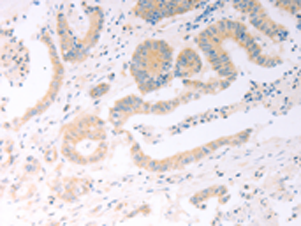 Anti-TRIM32 Rabbit Polyclonal Antibody