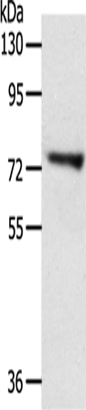 Anti-TRIM32 Rabbit Polyclonal Antibody