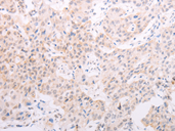 Anti-Tyrosinase Rabbit Polyclonal Antibody
