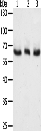Anti-Tyrosinase Rabbit Polyclonal Antibody