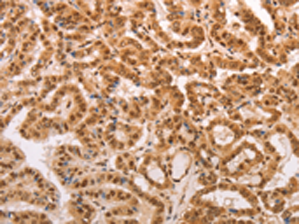 Anti-HEXIM1 Rabbit Polyclonal Antibody
