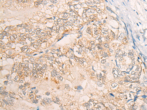 Anti-VPS18 Rabbit Polyclonal Antibody
