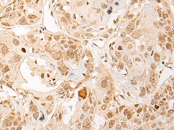 Anti-PPM1D Rabbit Polyclonal Antibody