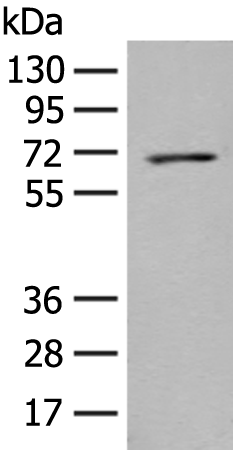 Anti-PPM1D Rabbit Polyclonal Antibody