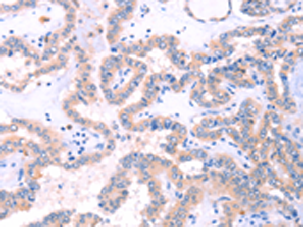 Anti-STXBP2 Rabbit Polyclonal Antibody