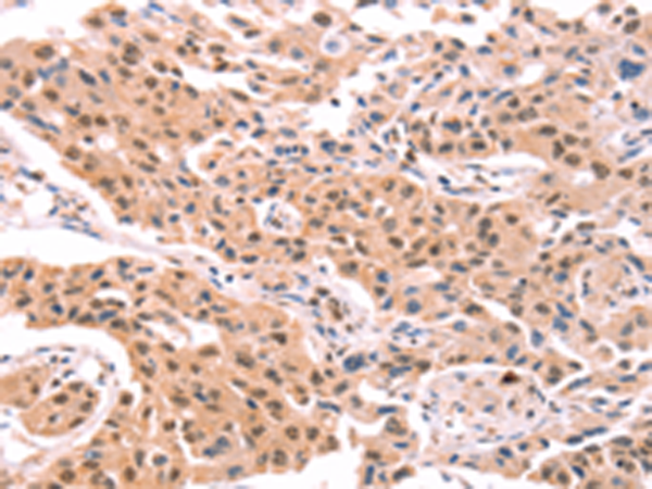 Anti-PROS1 Rabbit Polyclonal Antibody