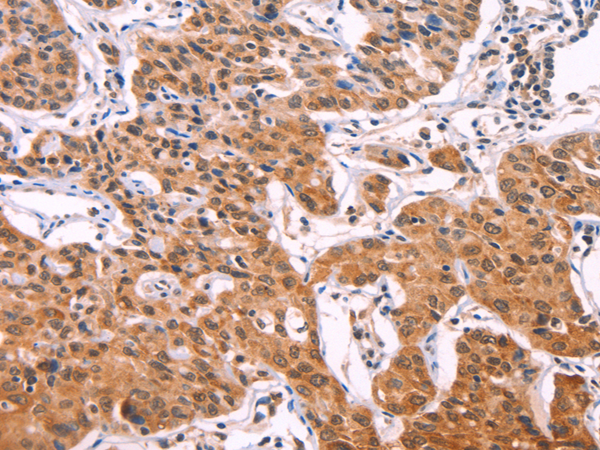Anti-IL-1 Receptor Like 1 Rabbit Polyclonal Antibody