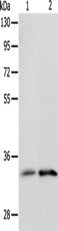 Anti-IL-1 Receptor Like 1 Rabbit Polyclonal Antibody