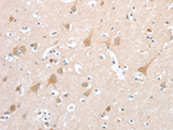 Anti-PCDHB16 Rabbit Polyclonal Antibody