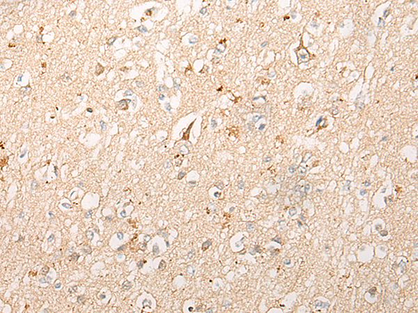 Anti-Meckelin Rabbit Polyclonal Antibody