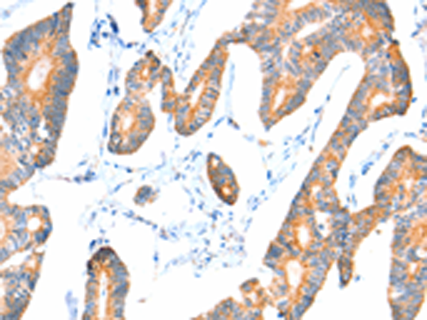 Anti-VANGL1 Rabbit Polyclonal Antibody