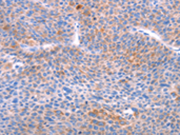 Anti-AADAC Rabbit Polyclonal Antibody