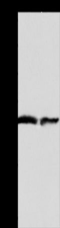 Anti-AADAC Rabbit Polyclonal Antibody