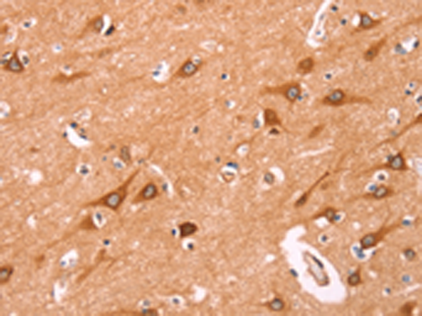 Anti-AADACL1 Rabbit Polyclonal Antibody