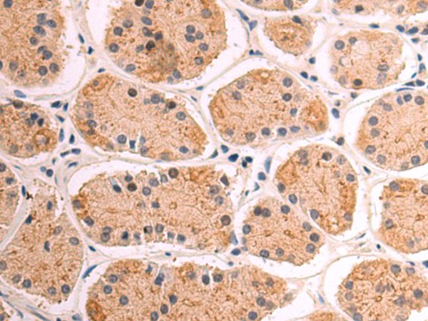 Anti-ABCB6 Rabbit Polyclonal Antibody