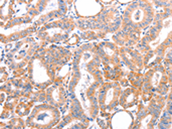 Anti-AOC1 Rabbit Polyclonal Antibody