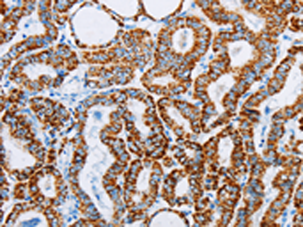 Anti-ACAA2 Rabbit Polyclonal Antibody