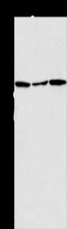 Anti-ACAA2 Rabbit Polyclonal Antibody