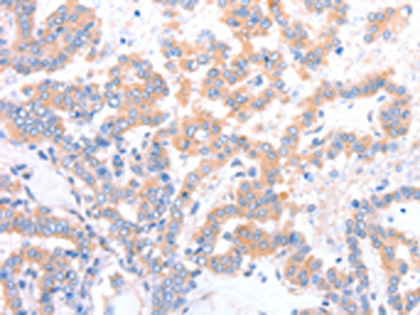 Anti-ACAD9 Rabbit Polyclonal Antibody