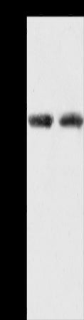 Anti-ACOT11 Rabbit Polyclonal Antibody