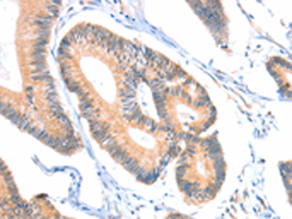 Anti-ACSM5 Rabbit Polyclonal Antibody