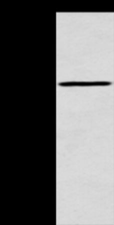 Anti-ACSM5 Rabbit Polyclonal Antibody