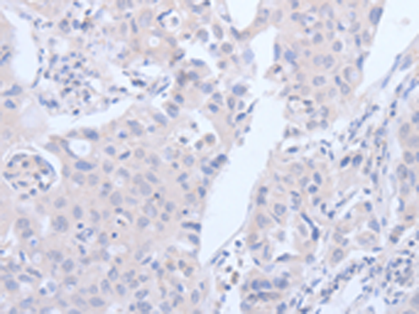 Anti-ALK-7 Rabbit Polyclonal Antibody