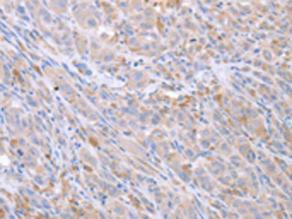 Anti-ACTL8 Rabbit Polyclonal Antibody