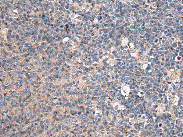 Anti-ACTR1A Rabbit Polyclonal Antibody