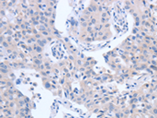 Anti-ACTR3B Rabbit Polyclonal Antibody