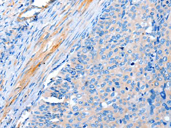 Anti-ACTRT1 Rabbit Polyclonal Antibody