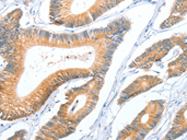 Anti-ACY3 Rabbit Polyclonal Antibody