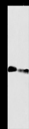 Anti-ACY3 Rabbit Polyclonal Antibody