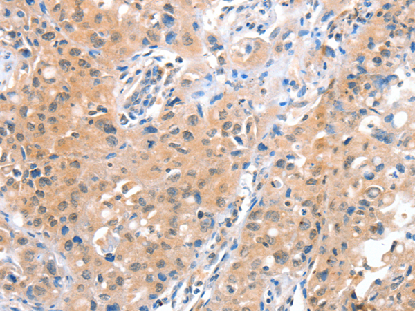 Anti-ACOT8 Rabbit Polyclonal Antibody