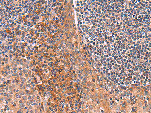 Anti-ACYP1 Rabbit Polyclonal Antibody