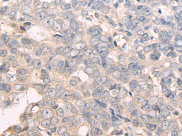 Anti-Adenosine Deaminase Rabbit Polyclonal Antibody