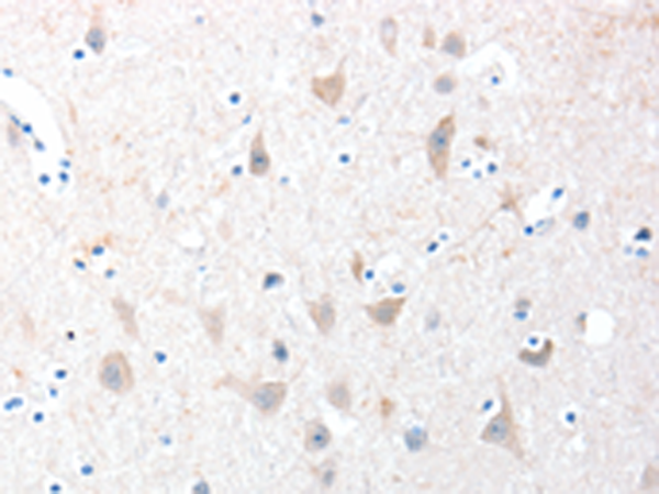 Anti-ADAM20 Rabbit Polyclonal Antibody